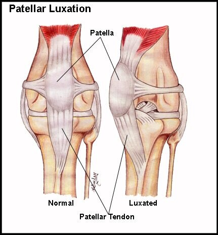 Patella+Luxation