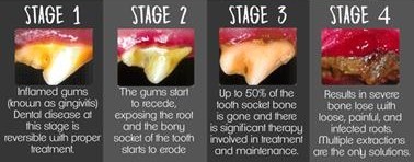 Dental Image